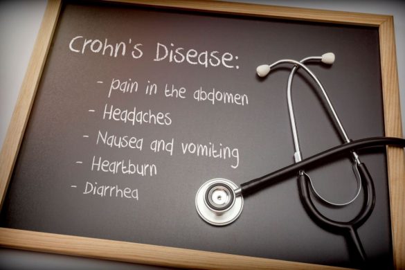 Crohn