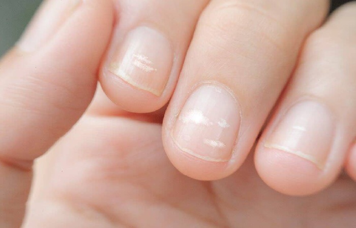 How to Avoid Stains on the Nails?