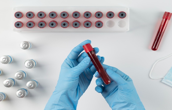 Discussion of Blood Group